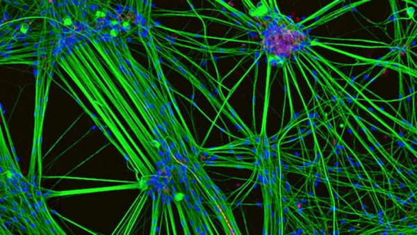 Ученые включили естественную защиту нейронов в модели бокового амиотрофического склероза