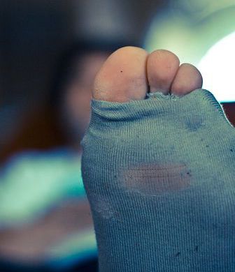 Китаец попал в больницу, понюхав собственные носки