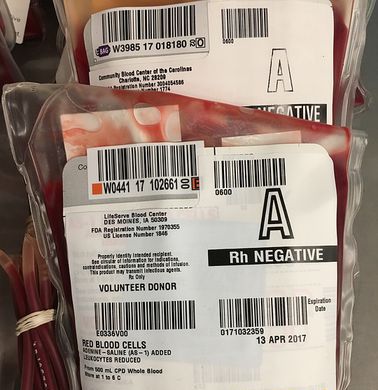 FDA призвало стариков не лечиться кровью молодежи