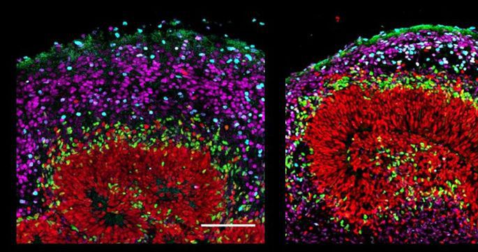 Биологи вырастили мини-мозги человека и шимпанзе