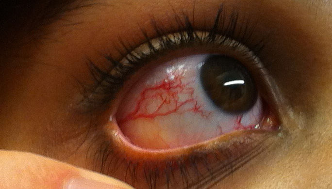 У россиян нашли мутации, вызывающие тяжелое заболевание