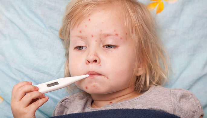Россия вводит неотложные меры против кори