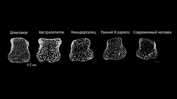 Как меняется скелет современного человека: самые необычные факты Как меняется скелет современного человека: самые необычные факты