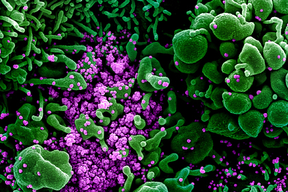 Раскрыт новый путь передачи коронавируса Раскрыт новый путь передачи коронавируса