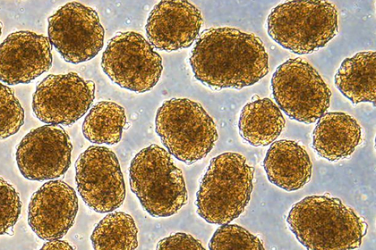 Найден новый способ навсегда побороть диабет Найден новый способ навсегда побороть диабет