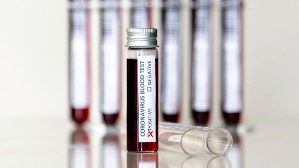 Глава МВД Австралии заразился коронавирусом