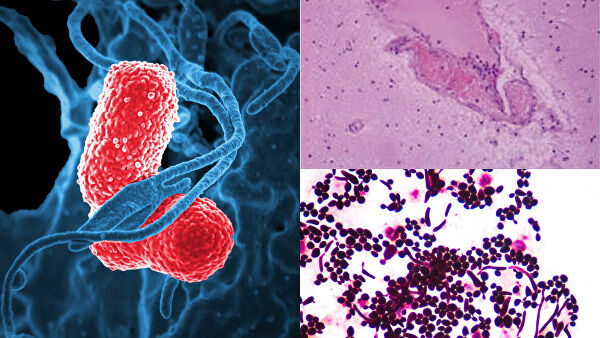 Алкоголики поневоле. Почему организм начинает вырабатывать спиртное