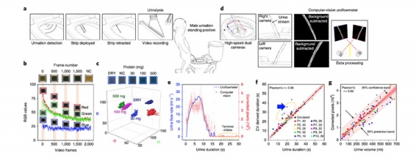 Создан &laquo;умный&raquo; туалет, способный проводить медицинские анализы