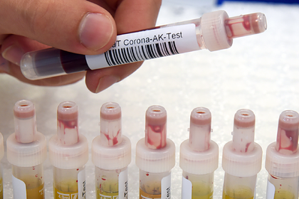 Стало известно о&nbsp;возможном исчезновении антител к&nbsp;коронавирусу спустя два месяца