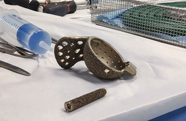 Ученые и медики поставят на поток цифровое проектирование умных имплантов Ученые и медики поставят на поток цифровое проектирование умных имплантов