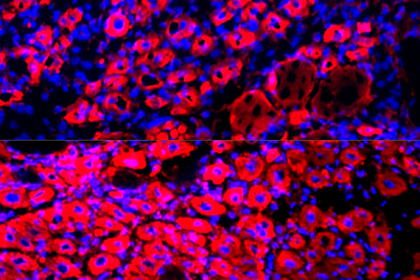 Открыт новый способ омолодить организм и&nbsp;продлить жизнь