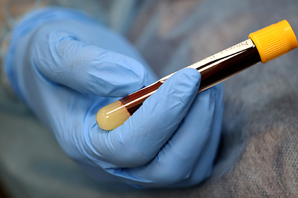 Названа главная причина смерти от&nbsp;коронавируса