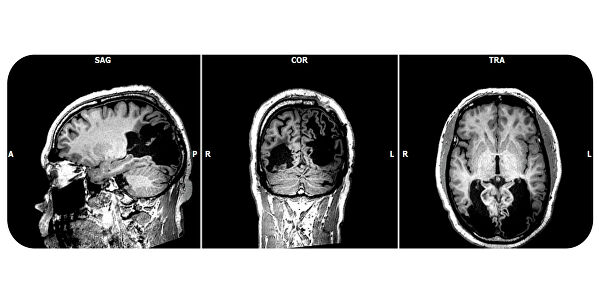 Ученые выяснили, что слепые на самом деле видят, не понимая этого Ученые выяснили, что слепые на самом деле видят, не понимая этого