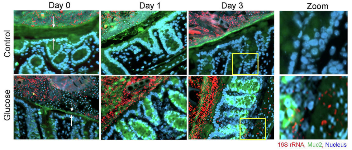 Ученые выяснили, почему сахар вызывает воспаление кишечника