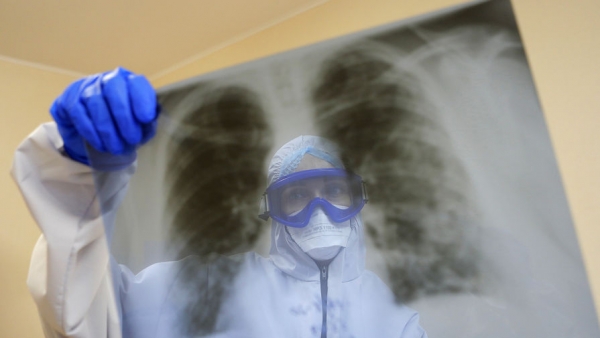 Искусственный интеллект поможет российским врачам диагностировать COVID-19