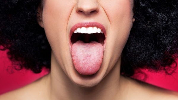 Ученые перечислили признаки рака в ротовой полости Ученые перечислили признаки рака в ротовой полости