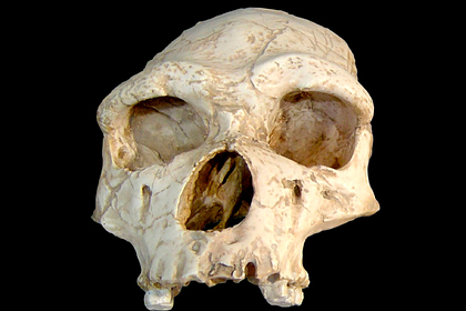 Объяснена уязвимость к&nbsp;тяжелому заражению коронавирусом