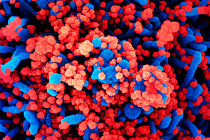 Раскрыта причина тяжелых осложнений от&nbsp;коронавируса у&nbsp;детей и&nbsp;взрослых