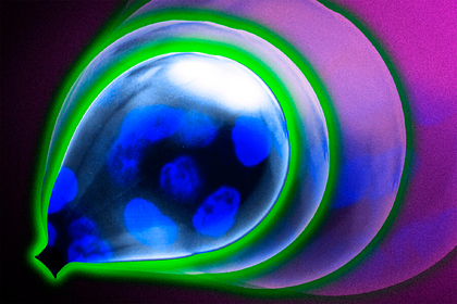 Найден способ предотвратить особо опасную форму рака