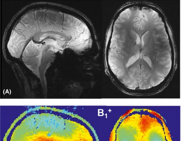 Физики повысили четкость снимков МРТ