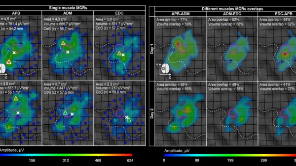 Магнитные импульсы помогли создать диагностические карты активности мышц