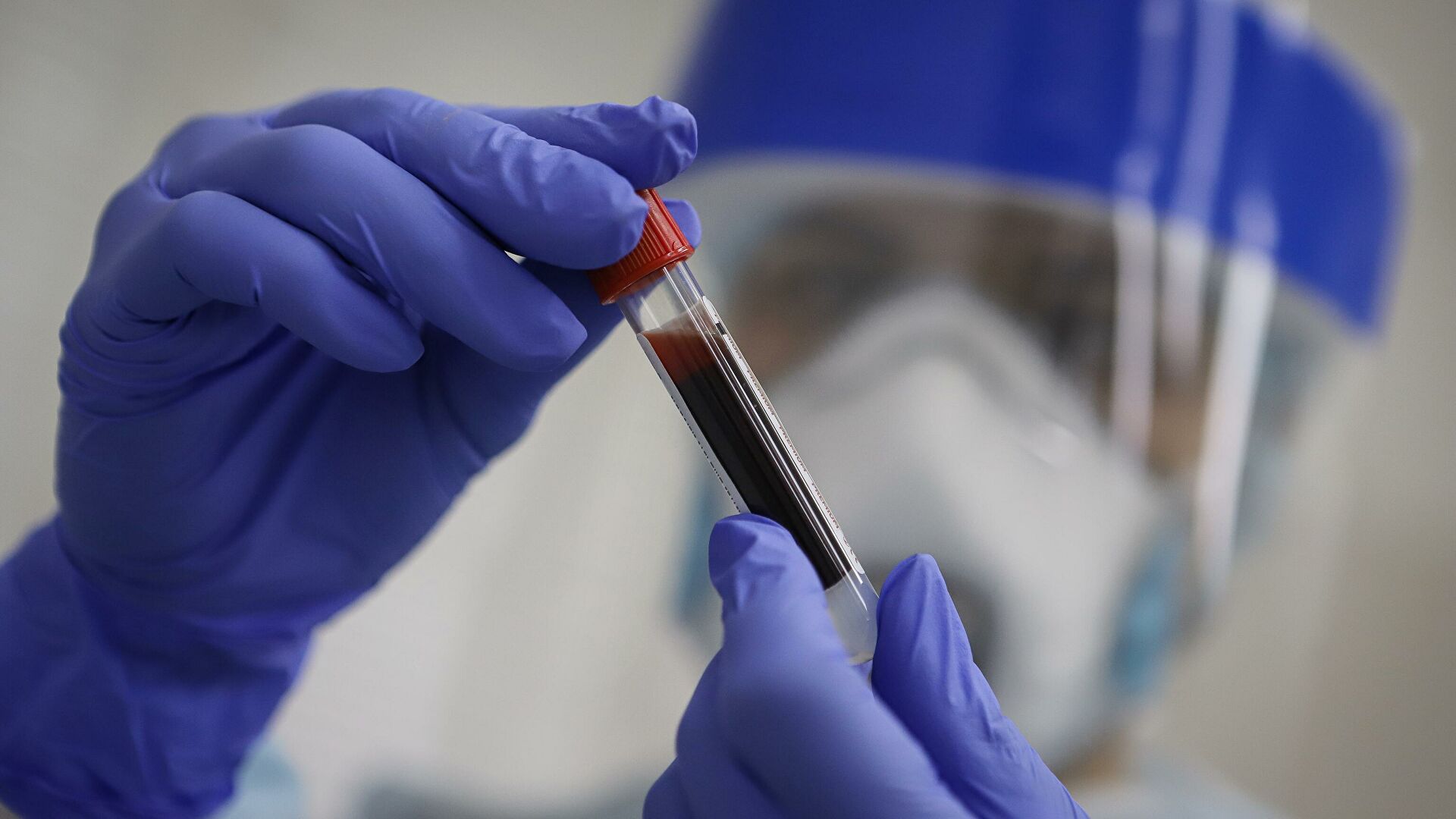 Антитело &mdash; личное дело. От чего зависит стойкость иммунитета к ковиду