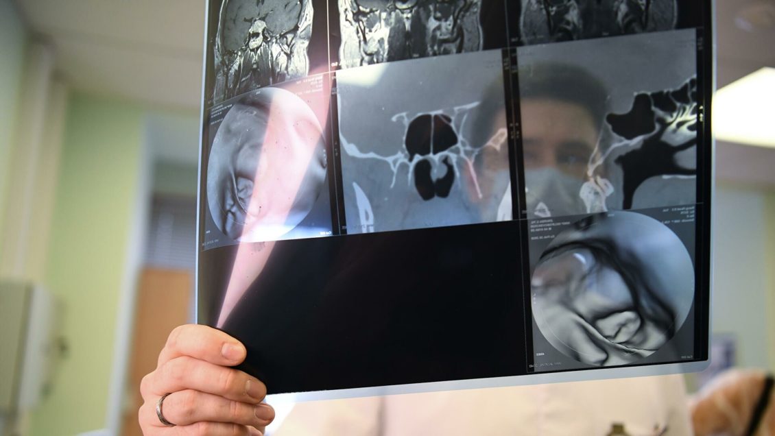 Ученые синтезировали эффективные соединения для противораковых препаратов