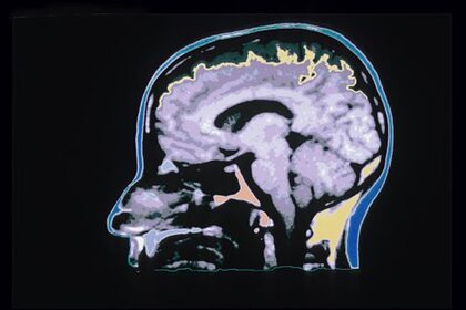 Ученые обнаружили указывающие на&nbsp;признаки рака &laquo;горячие точки&raquo; в&nbsp;мозгу
