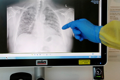 Врачи назвали кажущийся «безобидным» симптом рака Врачи назвали кажущийся «безобидным» симптом рака