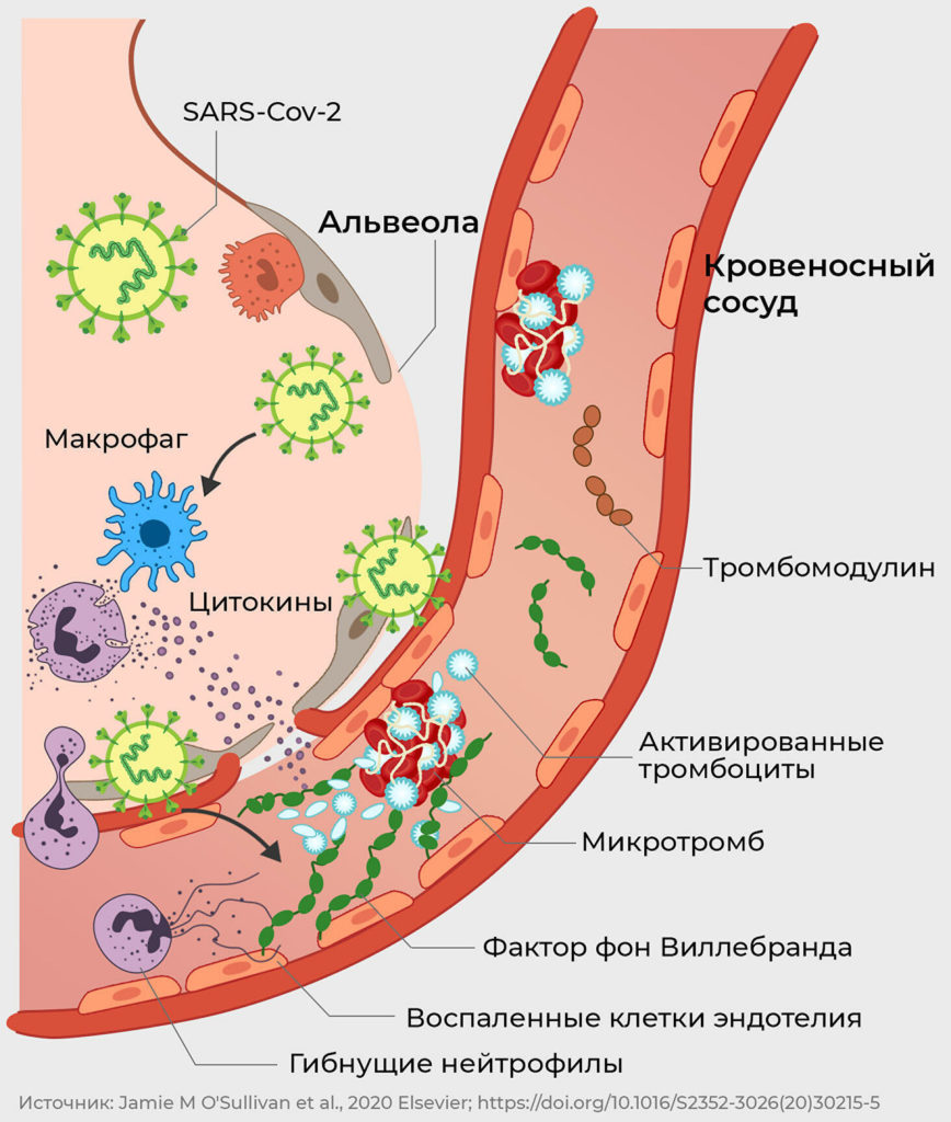 "Страдают легкие". Ученые рассказали о риске тромбоза при COVID-19