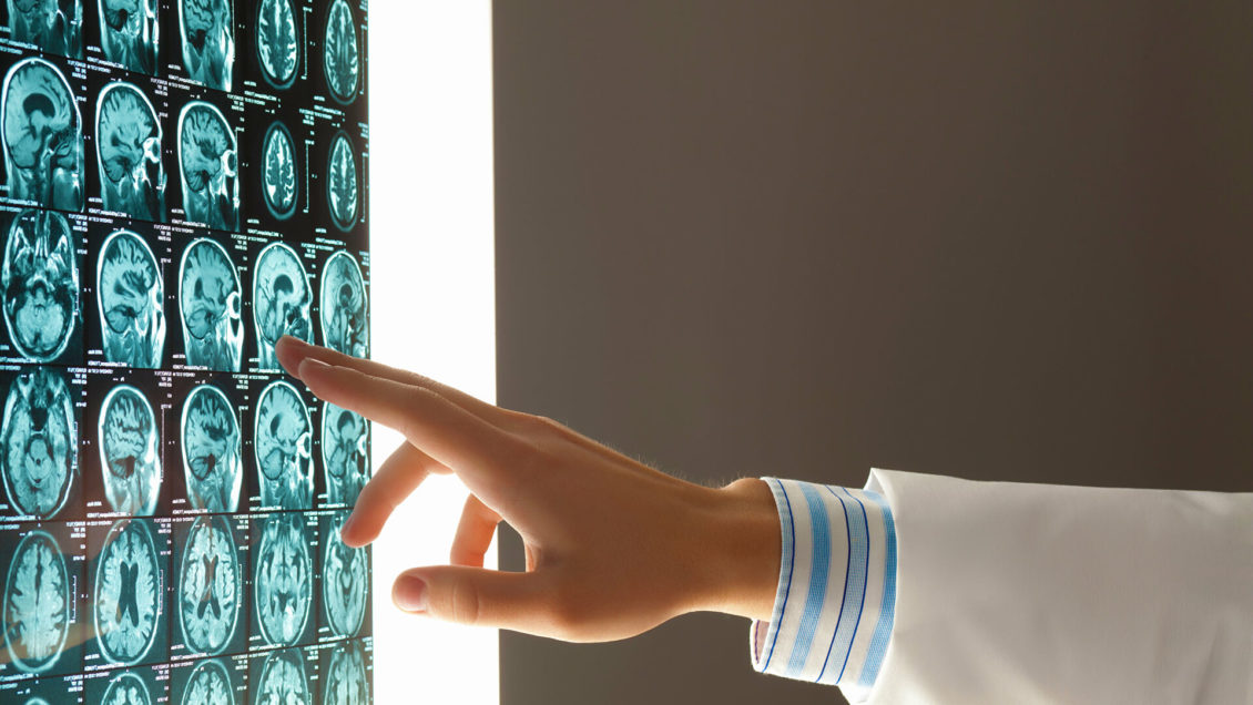 Эволюция полным ходом. Как тело человека изменилось за сто лет Эволюция полным ходом. Как тело человека изменилось за сто лет