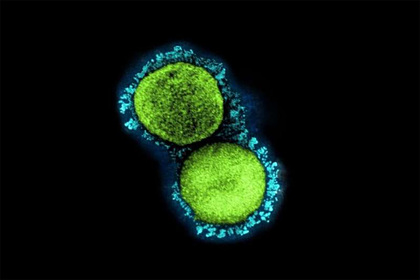 У коронавируса нашли уникальную способность к заражению У коронавируса нашли уникальную способность к заражению