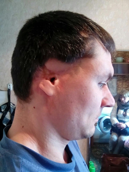 «Они хотят жить!» — людям Донбасса срочно нужна помощь (ФОТО, ВИДЕО)