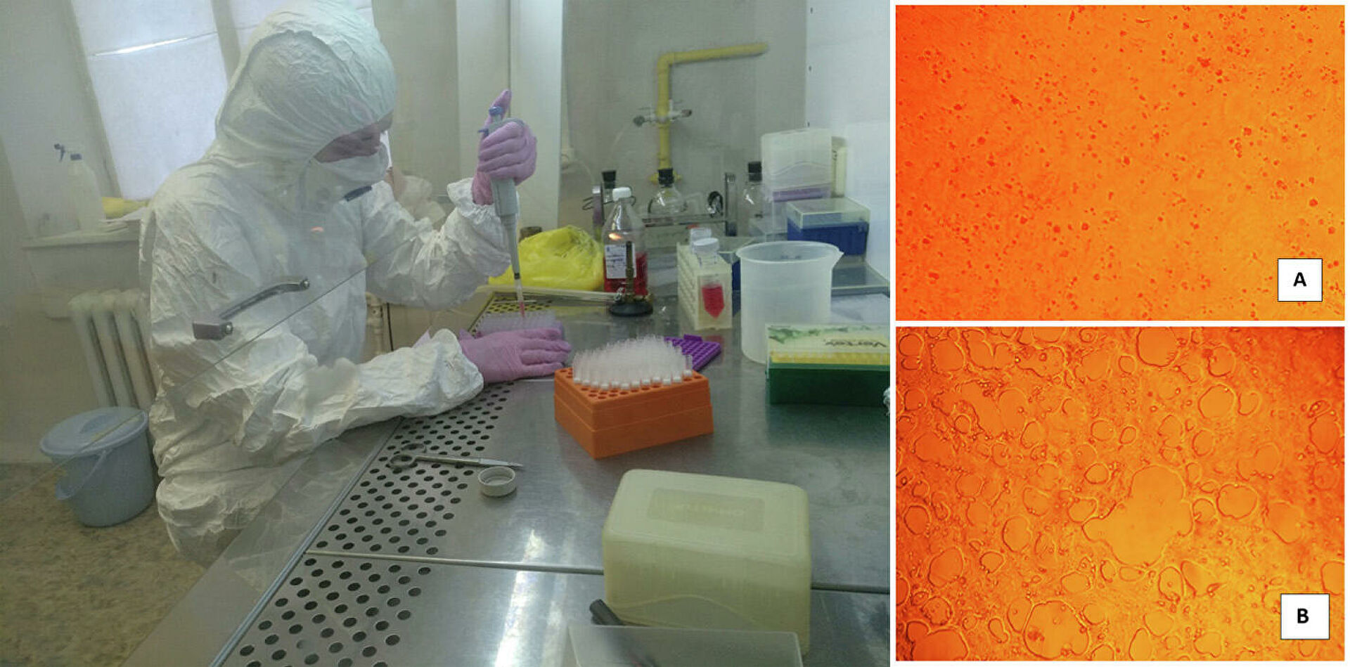 Ученые рассказали, как усилить противовирусный иммунитет