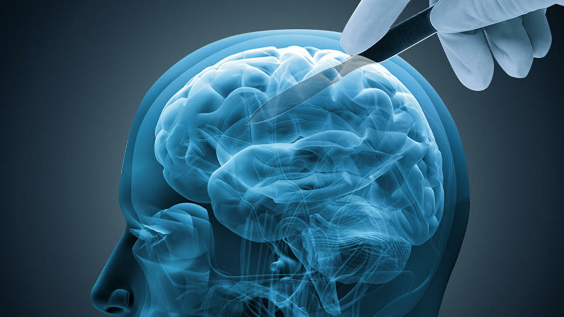 Российские ученые нашли способ остановить развитие болезни Альцгеймера