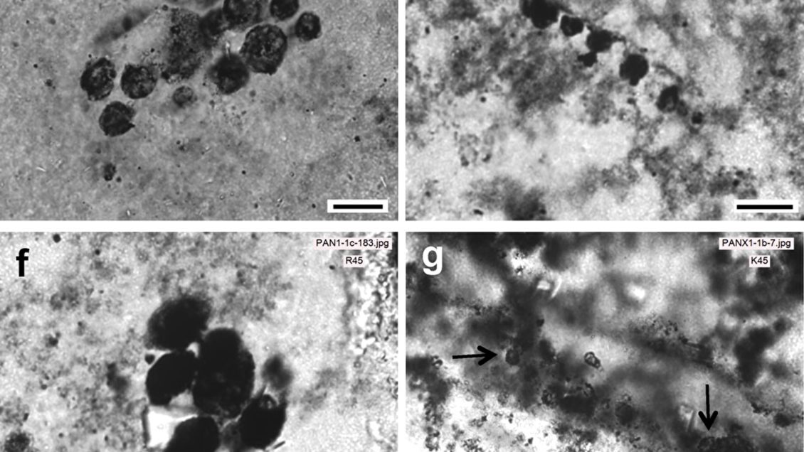 Ученые нашли микробов, изучение которых поможет исправить мутации ДНК Ученые нашли микробов, изучение которых поможет исправить мутации ДНК