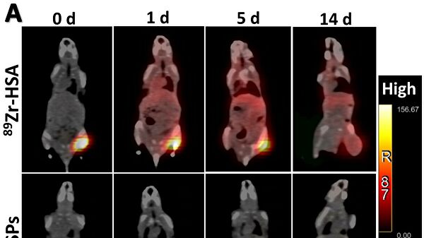 Ученые из России создали универсальное средство лечения рака Ученые из России создали универсальное средство лечения рака