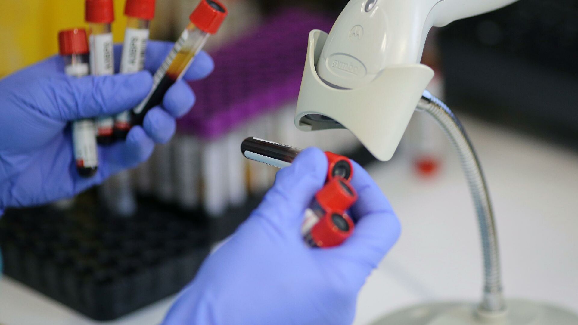 Доказана эффективность вакцины "Спутник Лайт" против штамма "дельта"