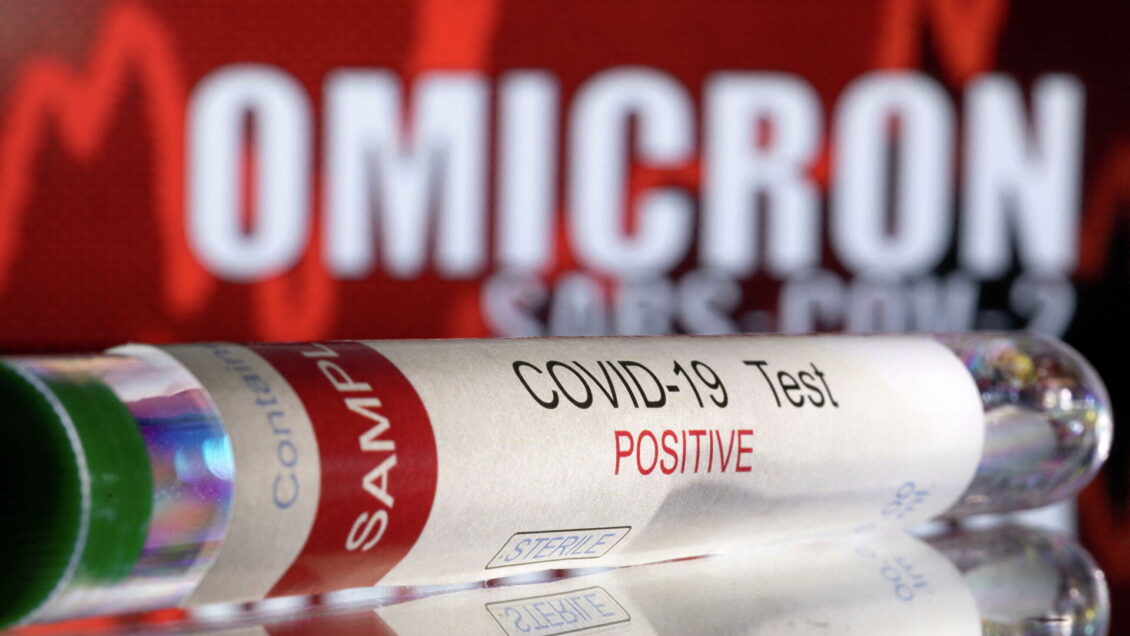 В Карелии выявили первый случай заражения "омикроном" В Карелии выявили первый случай заражения "омикроном"