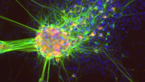 В Японии впервые провели операцию на позвоночнике с применением iPS-клеток В Японии впервые провели операцию на позвоночнике с применением iPS-клеток