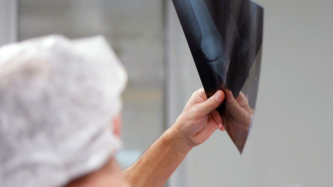 В России сертифицировали композитные протезы для суставов В России сертифицировали композитные протезы для суставов