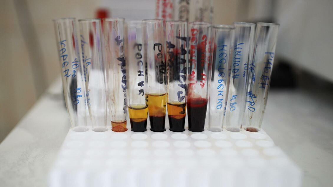 Сколько прививок защищают от омикрон-штамма