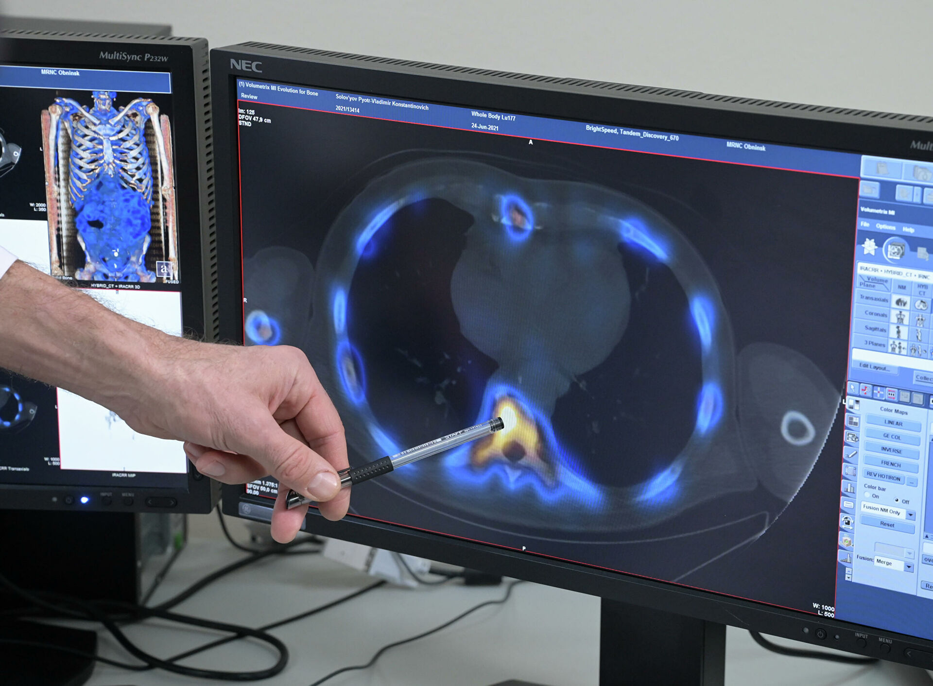 "Ситуация улучшилась колоссально". Как создают новое лекарство против рака "Ситуация улучшилась колоссально". Как создают новое лекарство против рака